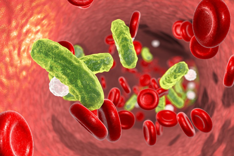 What is Sepsis? Blog Image