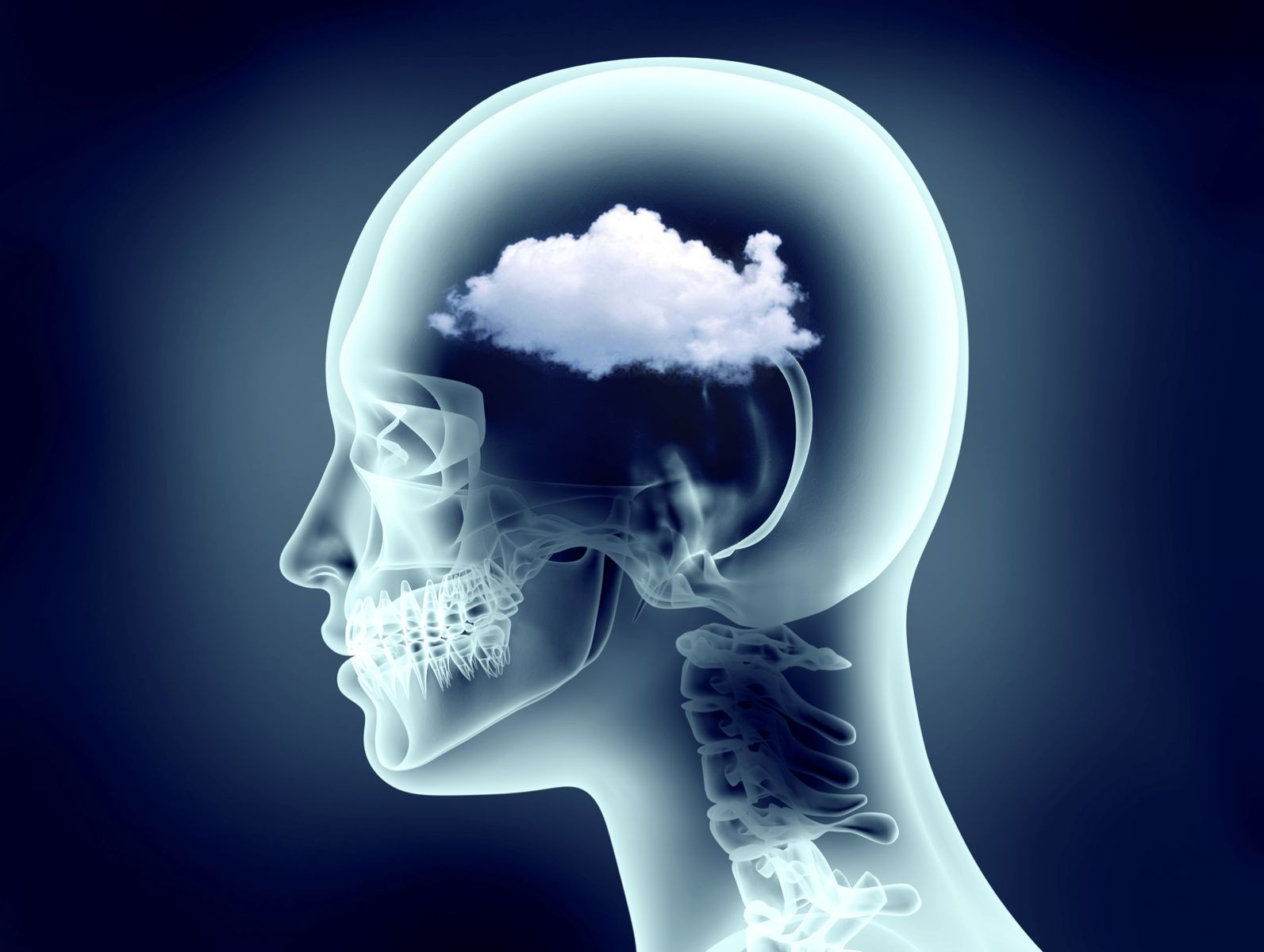 What is Brain Fog? Blog Image